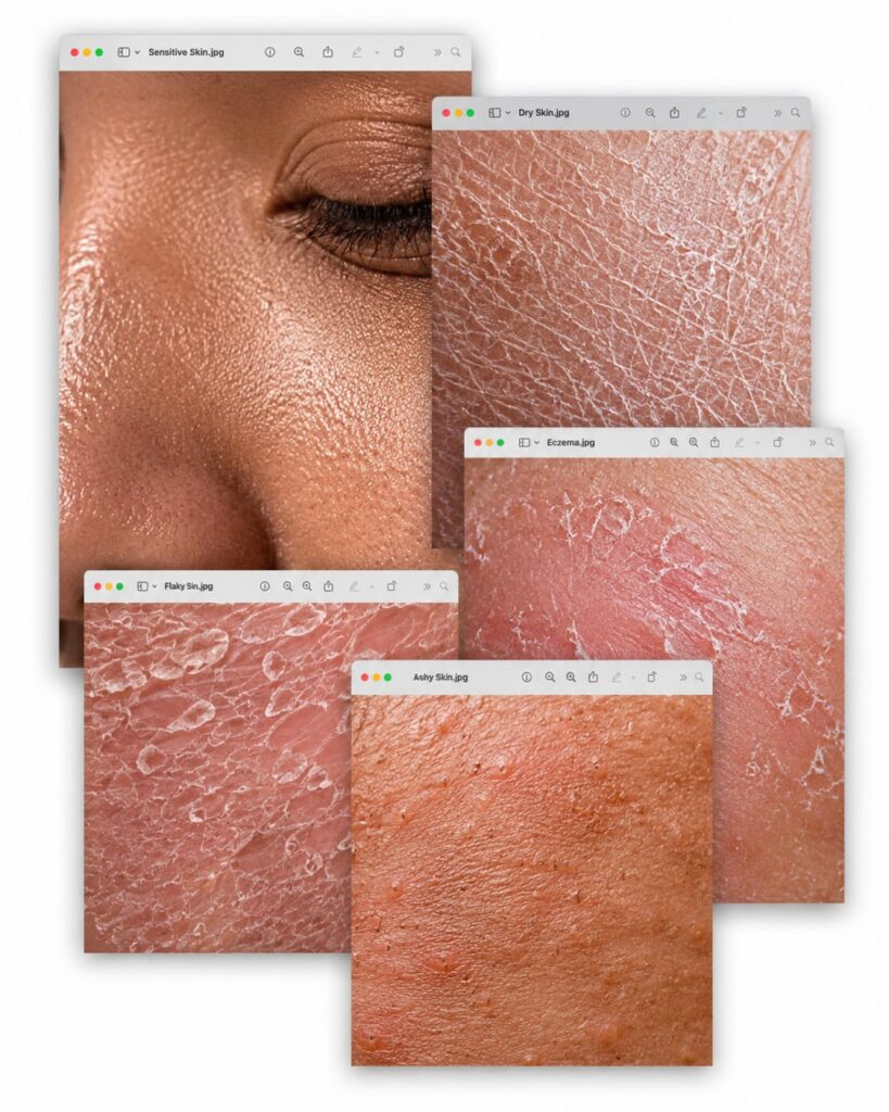 Symptoms of a Damaged Skin Barrier
